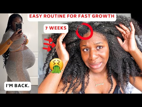 Rutinitas Pertumbuhan AWAL HINGGA AKHIR (Pasca Melahirkan) | 7 MINGGU BRAID TAKEDOWN | SANGAT det...
