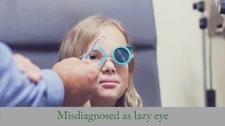 Misdiagnosed as Lazy Eye - Strabismus Treatment w/o Surgery as Adult