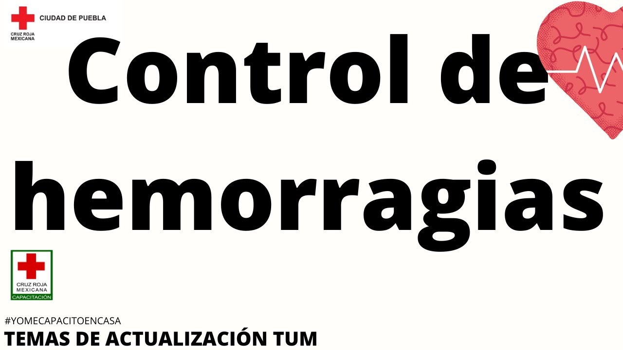 Sesiones de actualización  Control de hemorragias