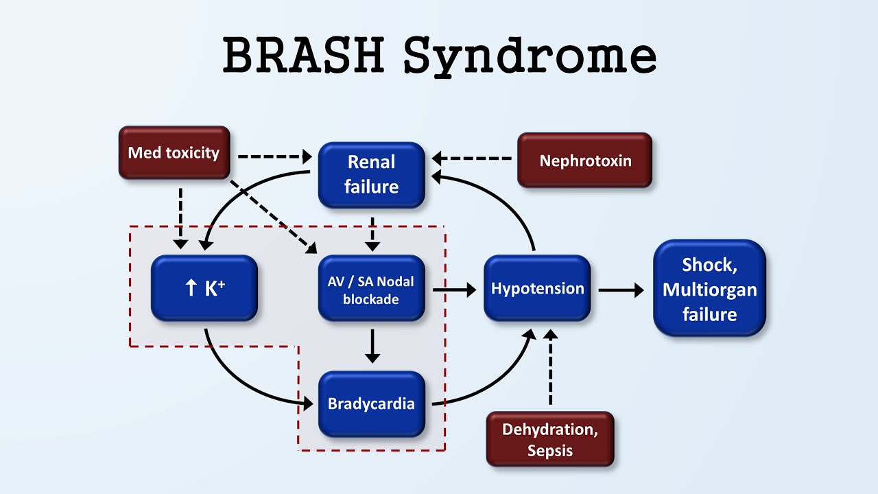 BRASH Syndrome (Bradycardia, renal failure, AV block, shock, hyperkalemia)