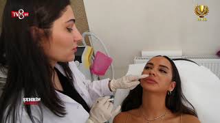 DOÇ DR GÜLBAHAR SARAÇ DERMATOLOJİ KLİNİĞİ - TV8int - ŞEHRİN NABZI