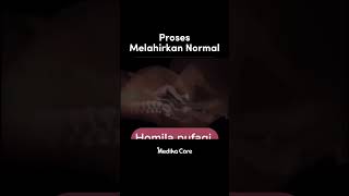 Download lagu Proses Melahirkan Normal - Medikacare mp3