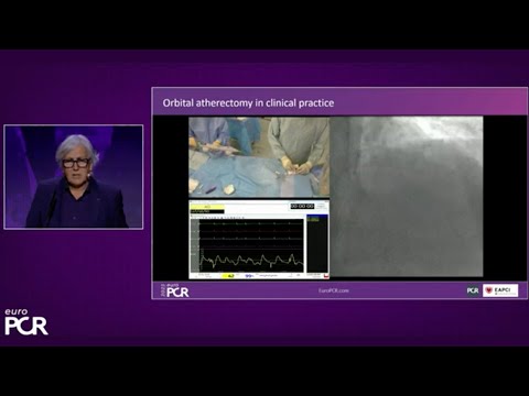 Orbital atherectomy, a versatile tool to manage complex vessel calcification scenarios - EuroPCR 23
