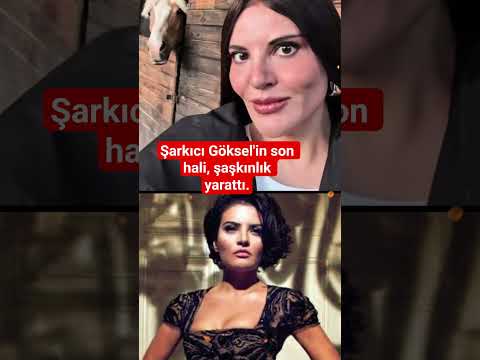 Şarkıcı Göksel'in son hali, şaşkınlık yarattı. #keşfet #viral #shorts
