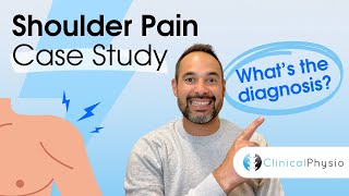 Shoulder Pain Case Study | Expert Physio explains Assessment, Diagnosis and Clinical Justification!