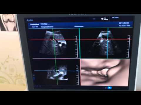 Prostatitis Röhrenbetrieb Behandlungseinheit Prostatitis