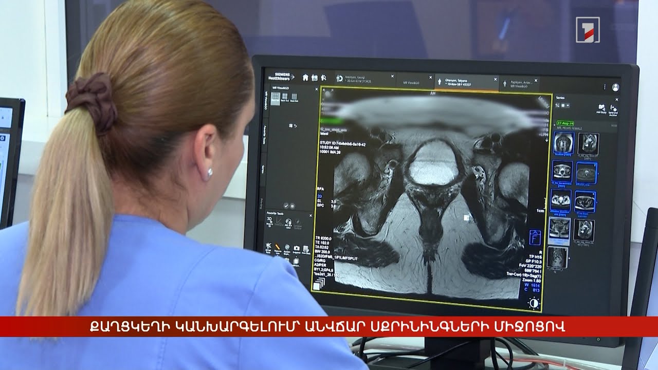 Քաղցկեղի կանխարգելում՝ անվճար սքրինինգների միջոցով