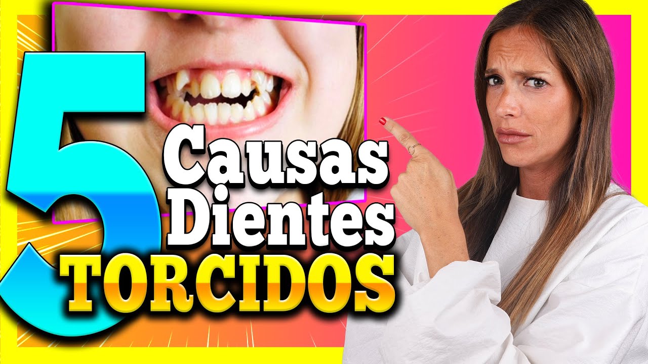 ▶️¡5 Causas 𝗦𝗢𝗥𝗣𝗥𝗘𝗡𝗗𝗘𝗡𝗧𝗘𝗦 ! de porque salen los 𝐃𝐢𝐞𝐧𝐭𝐞𝐬 𝐓𝐎𝐑𝐂𝐈𝐃𝐎𝐒 - SOLUCION 𝗦𝗜𝗡 BRACKETS ✅