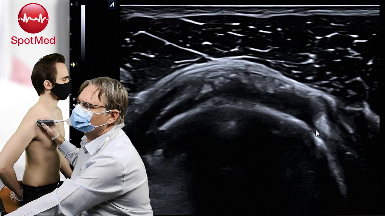 Webinar: USG stawu ramiennego