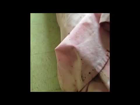 One of the Most Severe Bed Bug Infestations Found in Neptune, NJ