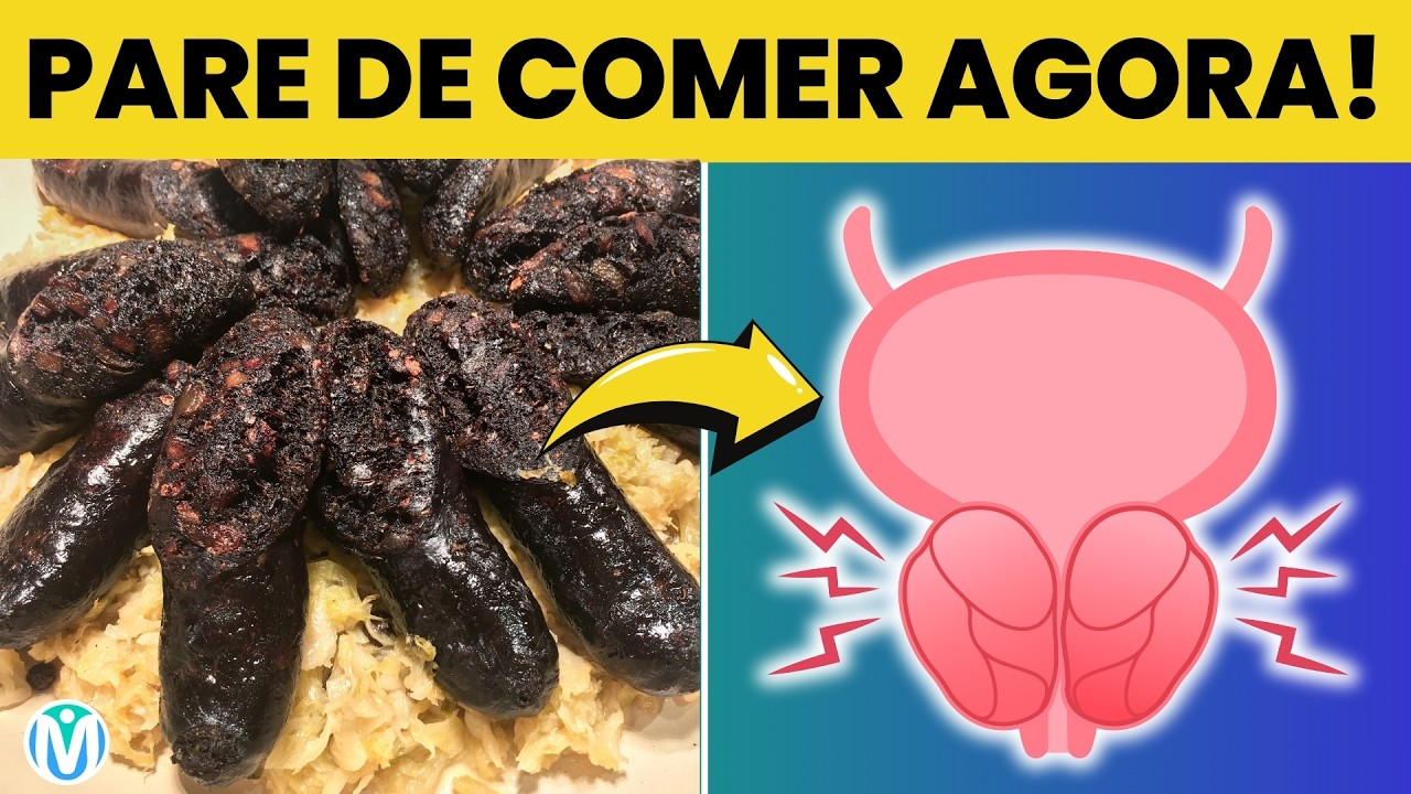 PARE DE COMER Estes 7 Alimentos Se Você Tem PRÓSTATA Aumentada