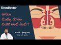 What is the actual crooked nose? | Deviated Nasal Septum | In Telugu
