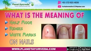 What is the meaning of Half Moon, Ridges and White Marks on Nails