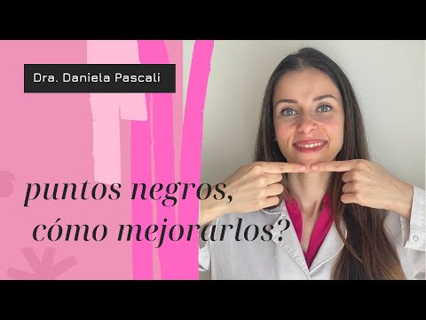 Adiós puntos negros