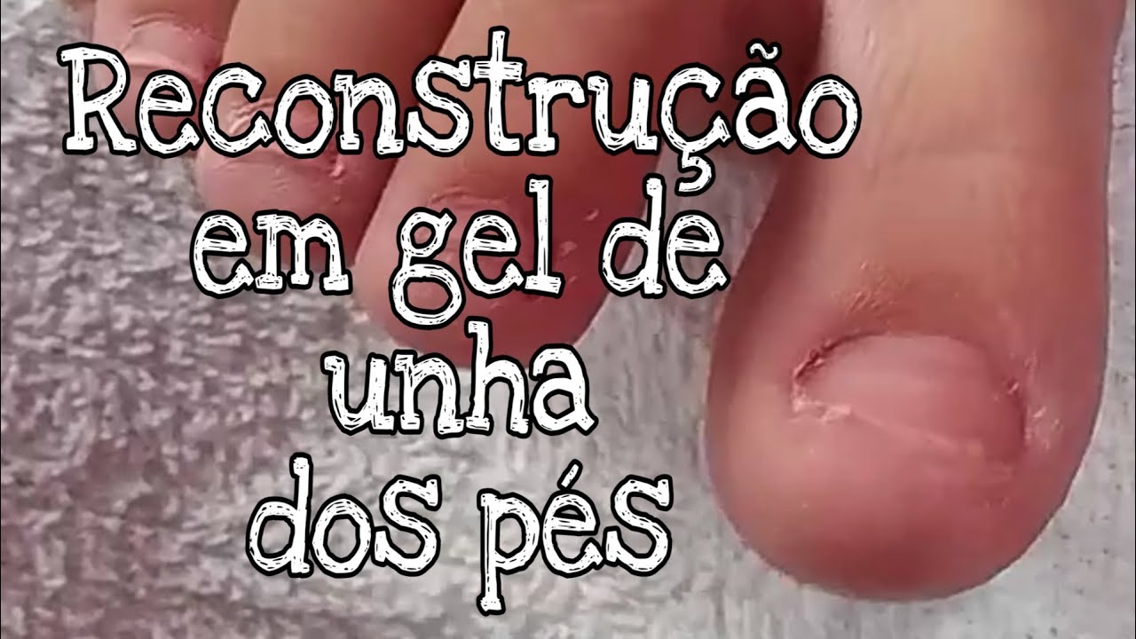 Reconstrução em gel de unha do pé