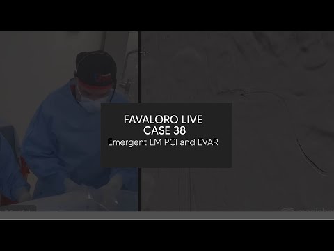 Favaloro Live Case N° 38 - Emergent LM PCI and EVAR (done for MedStream360)