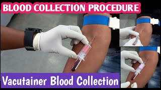 Download lagu Blood Collection Technique | How to Blood Collection | Vaccutainer Blood Collection Method mp3 Download lagu Blood Collection Technique | How to Blood Collection | Vaccutainer Blood Collection Method mp3
