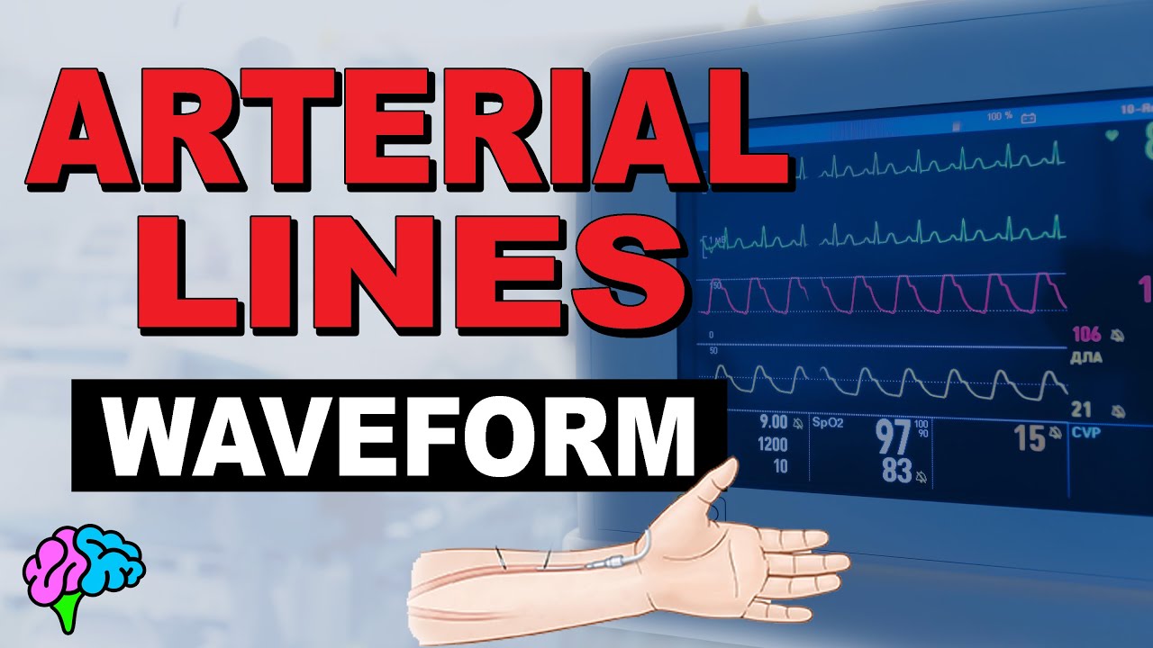 The Arterial Line Waveform EXPLAINED!