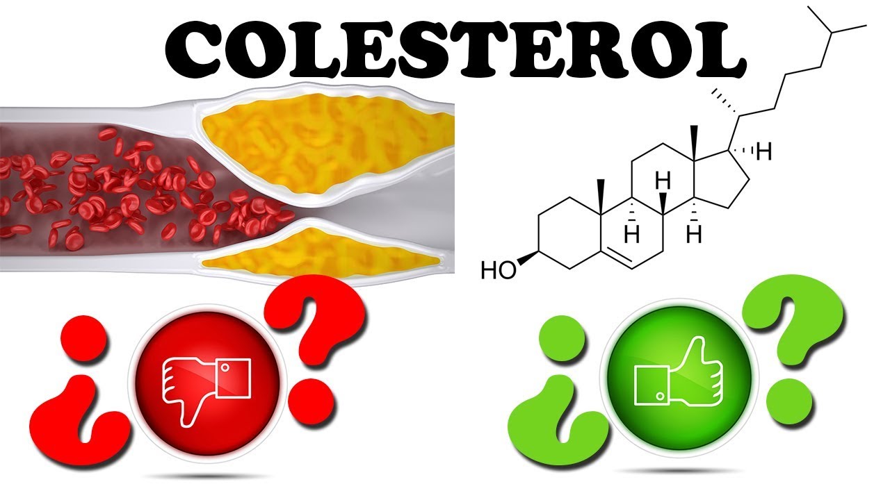 COLESTEROL BUENO, MALO, HDL Y LDL | QUE SON