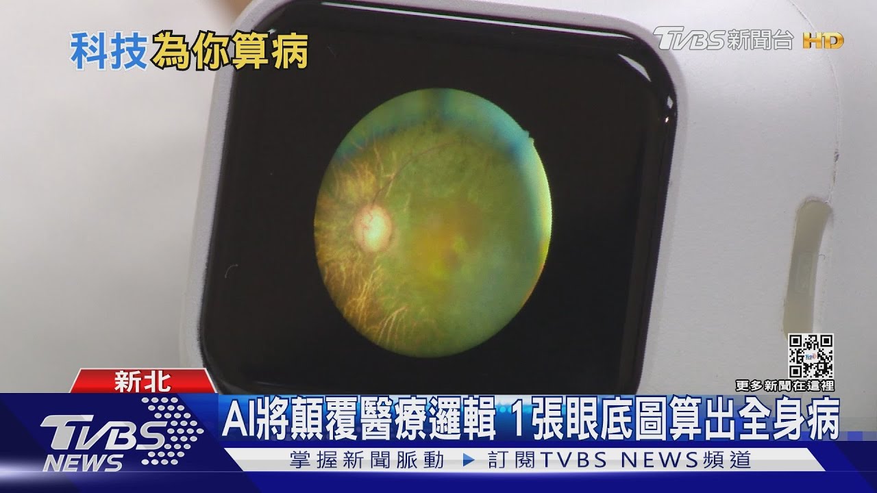 AI算出能活多久? 一張眼底圖透露全身潛在疾病