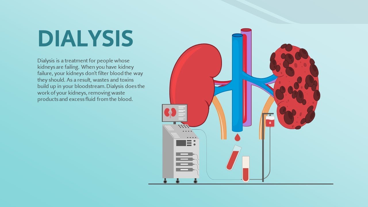 Dialysis Animated PowerPoint Template