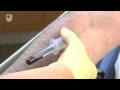 Taking A Blood Sample Diabetes Care 6 6