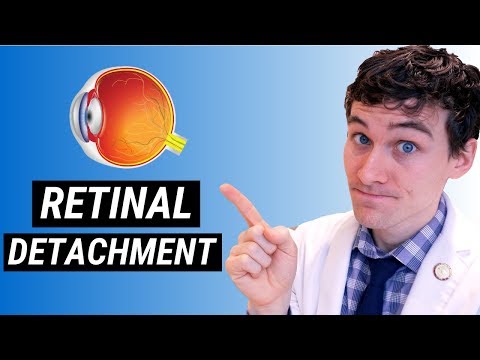 Retinal Detachment Symptoms and Treatment | How Retinal Detachment is Treated Video