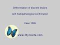 Differentiation Of Discrete Lesions Case 1589