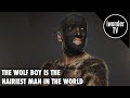 The Hairiest Man In The World The Wolf Man