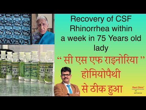 Recovery of CSF Rhinorrhea within a week in a 75 Years old lady from Bhagalpur