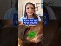 3 Signs Your Dog Has Ear Infections (Vet Reveals) 🐶🧑‍⚕️👀 #shorts