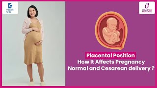 Placental Position affecting Normal & Cesarean-Dr.Rupam Arora of Cloudnine Hospitals|Doctors' Circle