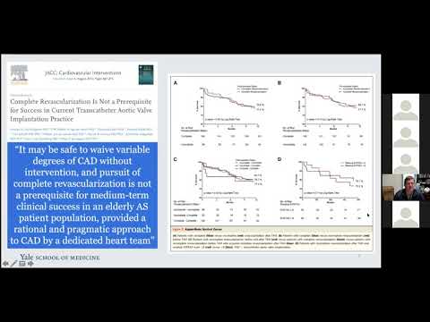 Management of Coronary Disease Pre- and Post TAVR.