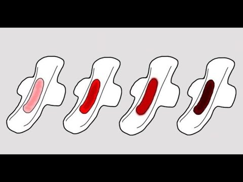 Bandage für das Sprunggelenk über den Zähler Als Ergebnis werden die Gelenke, um