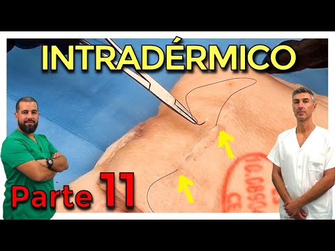 PUNTO CONTINUO INTRADÉRMICO – CIRUGÍA MENOR y SUTURAS (Parte 11)