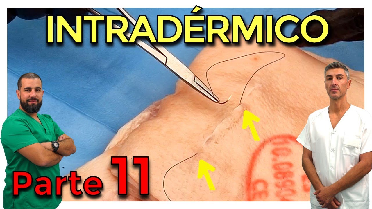 PUNTO CONTINUO INTRADÉRMICO – CIRUGÍA MENOR y SUTURAS (Parte 11)