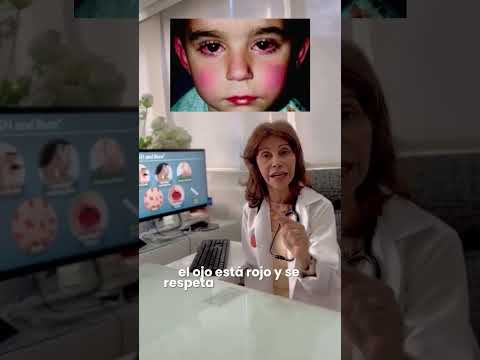 video UdN0ziZsSF8