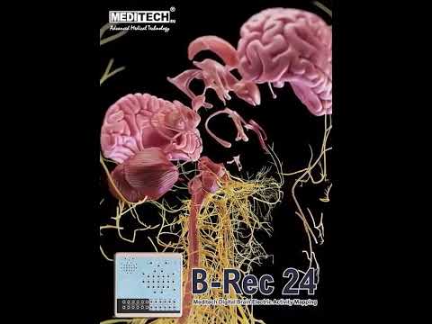 Introducing the B-Rec 24, a revolutionary digital brain electric activity mapping device! 🧠✨