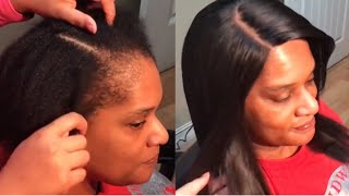 Natural sew in AFTER braids damage your edges!