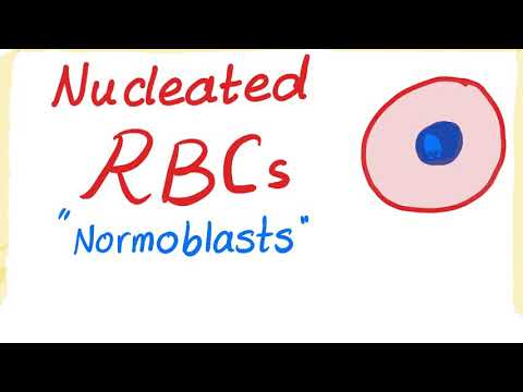 Nucleated RBCs (Normoblasts)