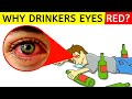 Why Does Your EYES TURN RED When You DRINK? | Wine | Champagne | Vatka | WHY?