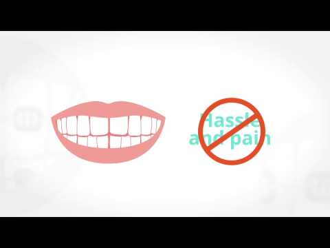 download lagu mp3 mp4 Invisible Braces In Dubai, download lagu Invisible Braces In Dubai gratis, unduh video klip Invisible Braces In Dubai