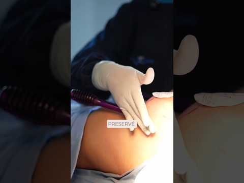 Denise Ventura Perez-23