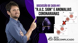 EcoDescomplicado - Discussão de caso AO VIVO #041 -  RAC Sign e as Anomalia das Artérias Coronárias