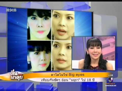 คลิกเพื่อดูคลิปวิดีโอ