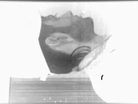 Qarizma - Sensizlige Dayanamam - byRG