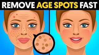 The quickest way to remove age spots