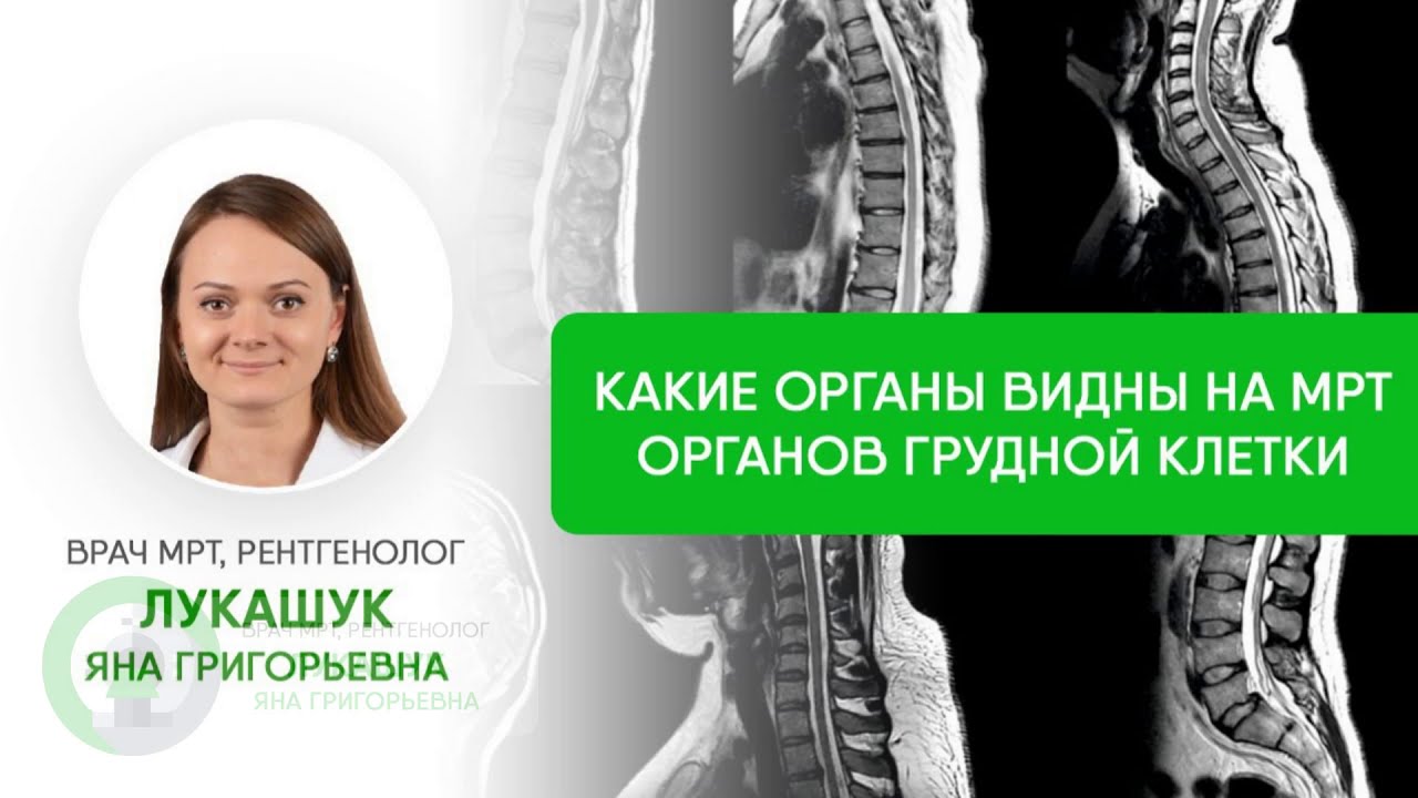 Что покажет МРТ грудной клетки