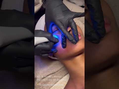 Santé Clínica Estética Barcelona