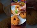 ശെടാ ഇത് ഇത്രസൂപ്പർ ആയിരുന്നോ... Cheese chicken donuts Ramadan speci